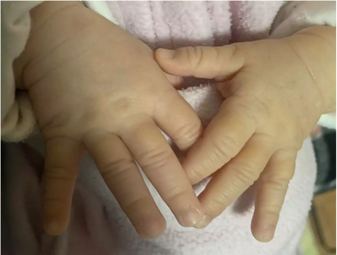 Justiça fixa pena de babá por tortura contra bebê de oito meses no RS